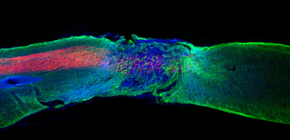 Spinal cord