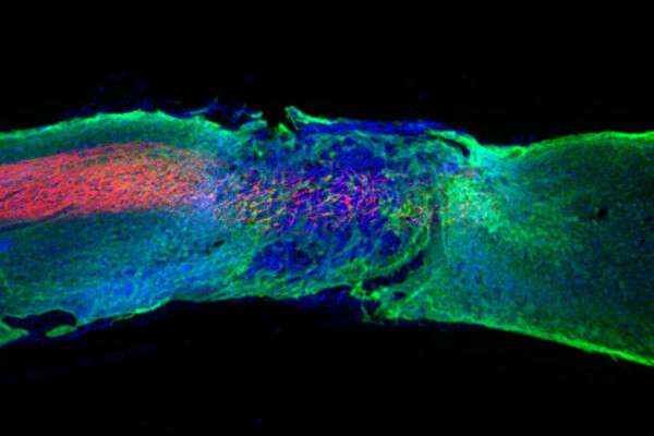 Spinal cord treatment