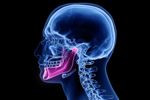 Jaw bone