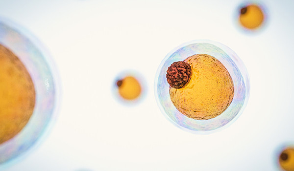 field of fat cells, High quality 3d render of fat cells, cholesterol in a cells