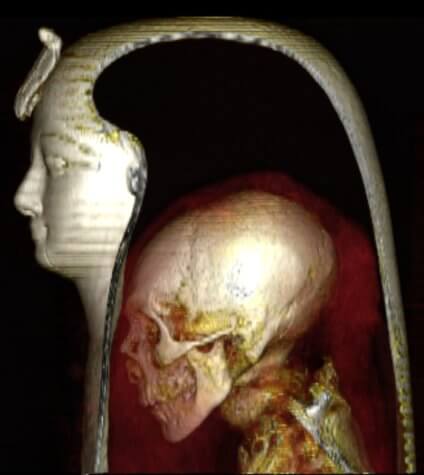 amenhotep head mummy