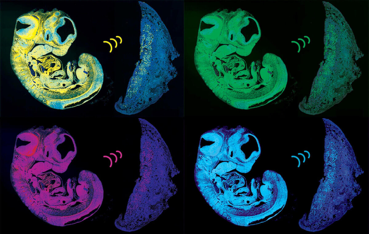 Image showing sections of the fetus and placenta.