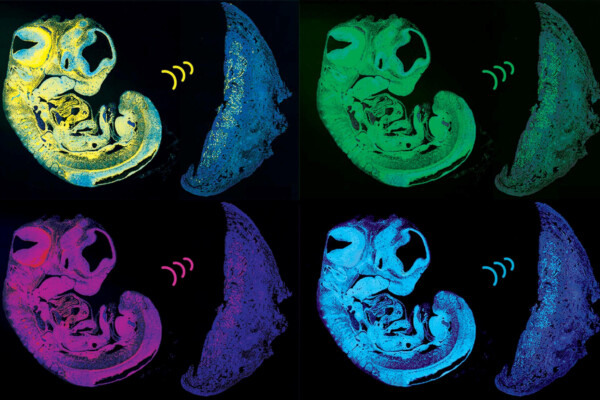 Image showing sections of the fetus and placenta.