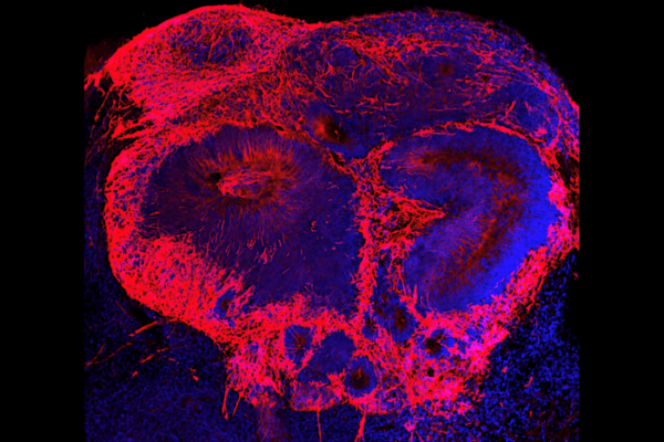 minibrain
