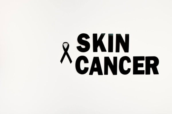 skin cancer