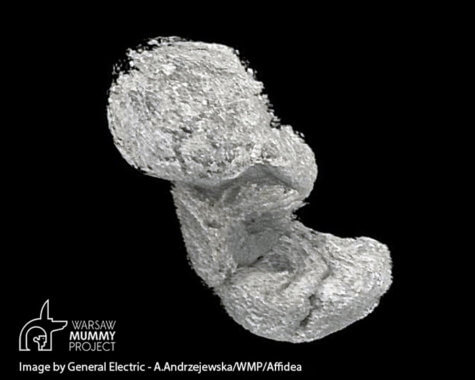 Fetus found in Egyptian mummy
