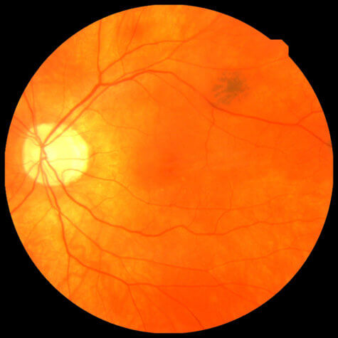 Eye scan