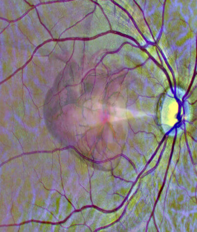 Eye scan