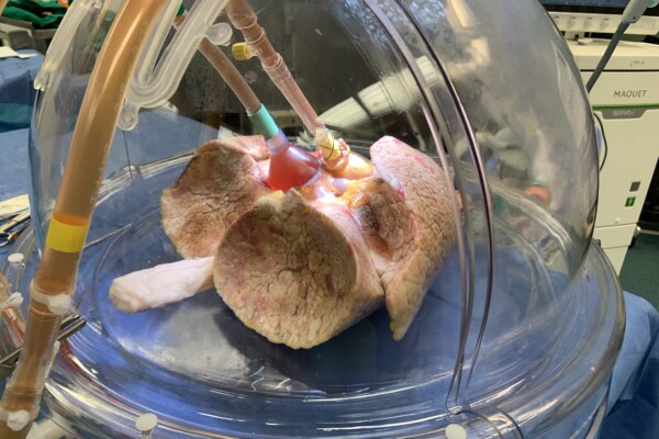 Universal blood type organs