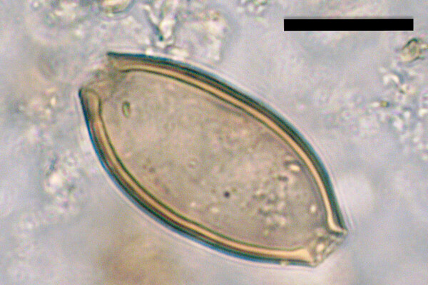 Microscopic egg of whipworm