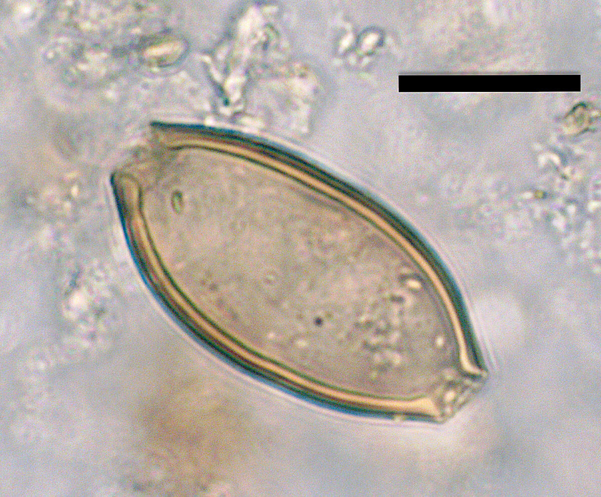 Microscopic egg of whipworm