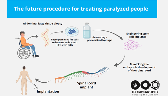 treating paralysis
