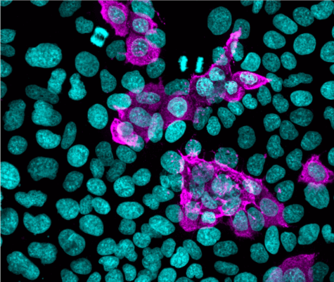 covid-cells-infection