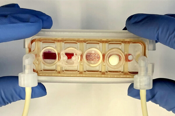 Organs on a chip