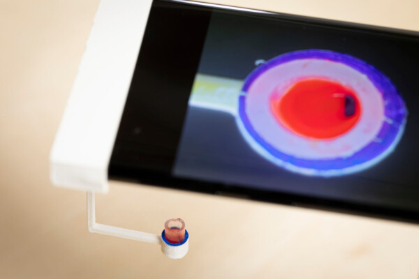 Blood clot app