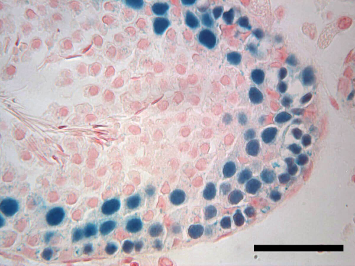 Male fertility treatment study
