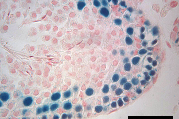 Male fertility treatment study
