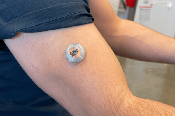 Wearable technology: health tracker on arm