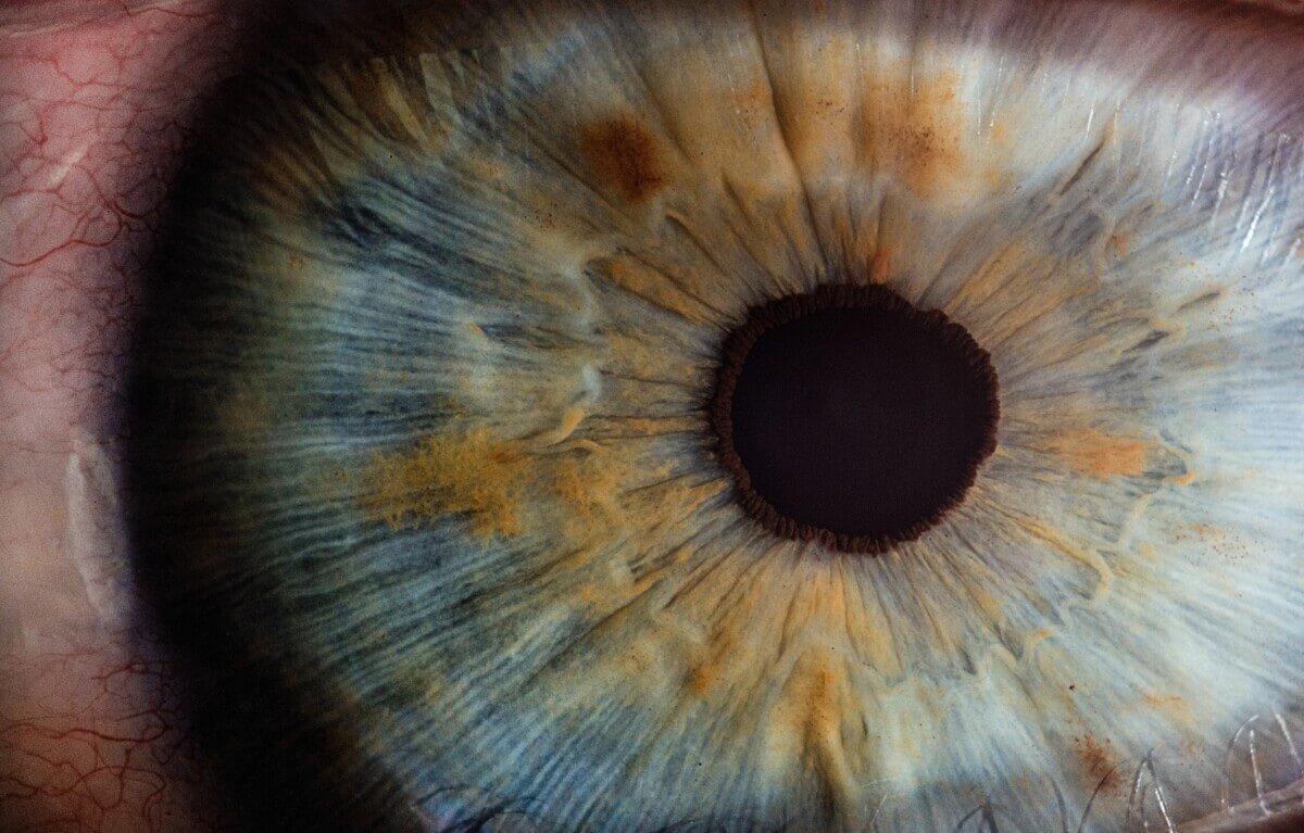 Iris of eye