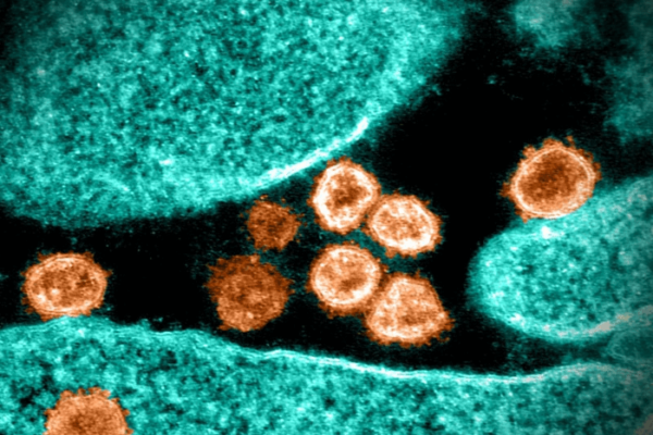 covid allergy