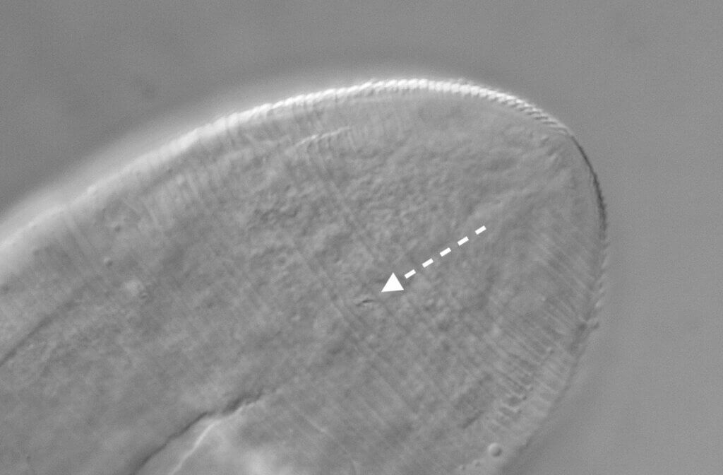 Demodex folliculorum mite
