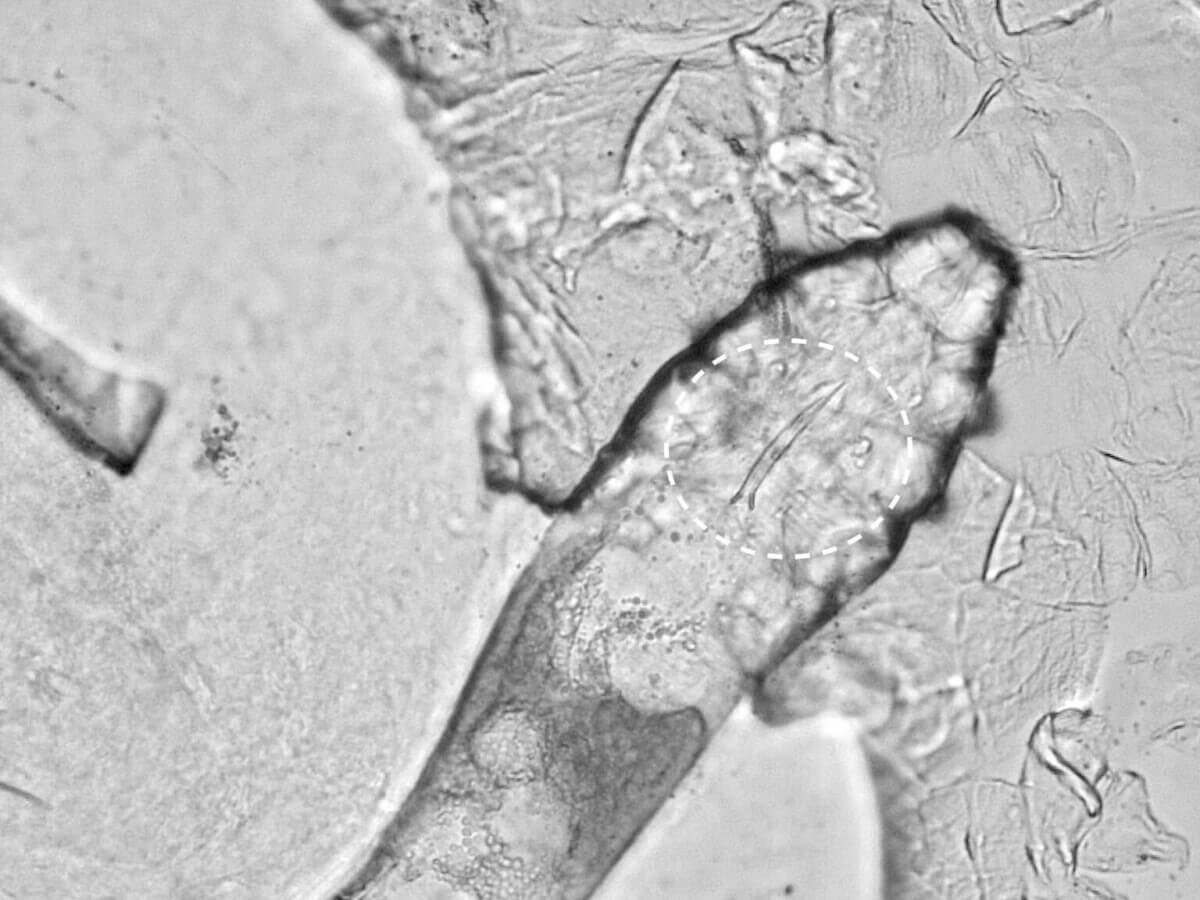 Demodex folliculorum mite