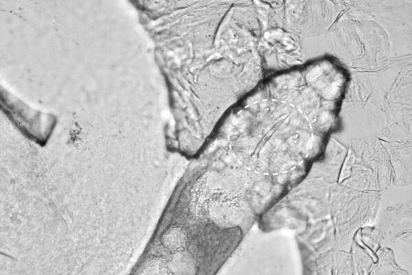 Demodex folliculorum mite