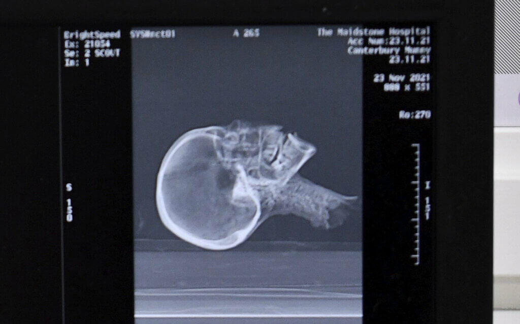 Egyptian Mummy head CT image.