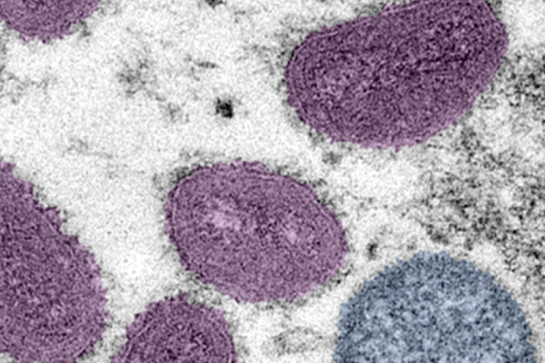 Monkeypox virus
