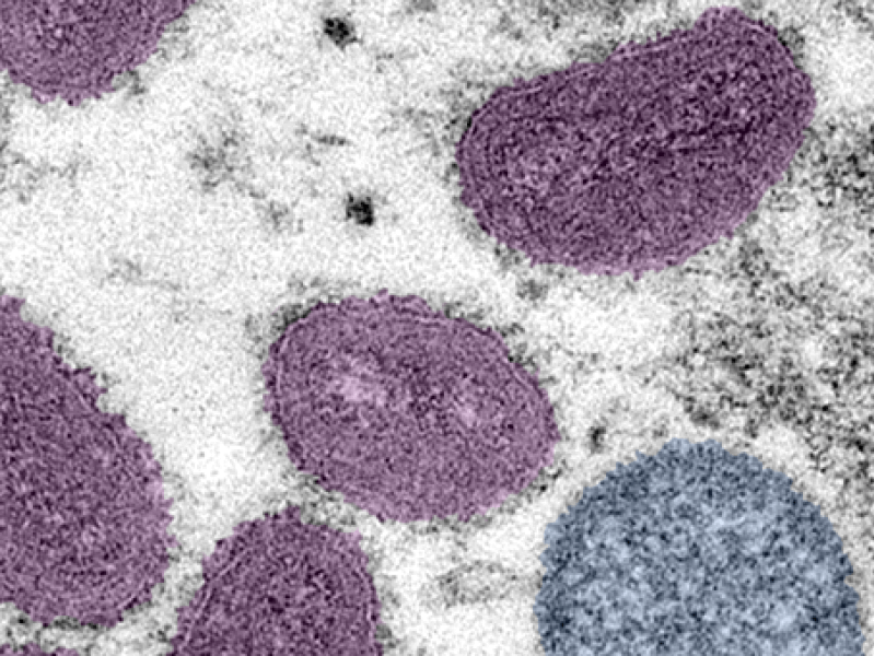 Monkeypox virus