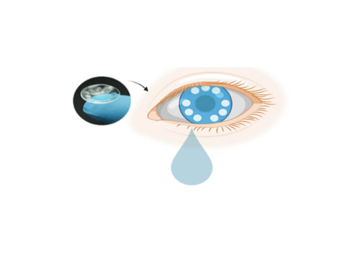 Smart contact concept