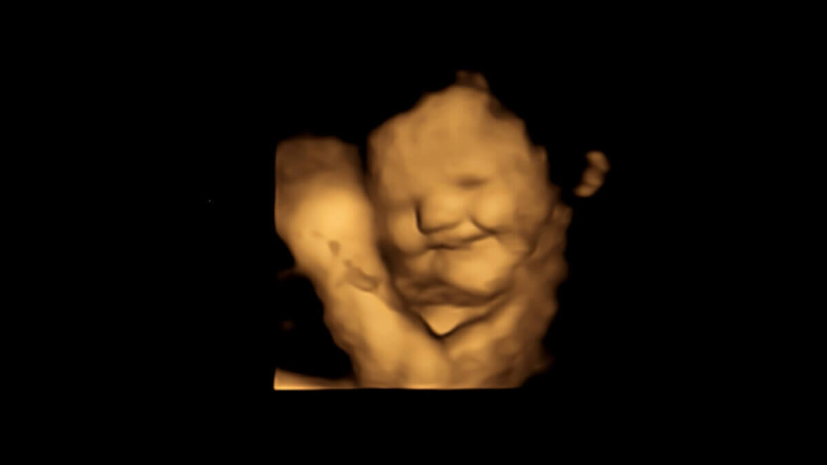 Laughter-face reaction scan image