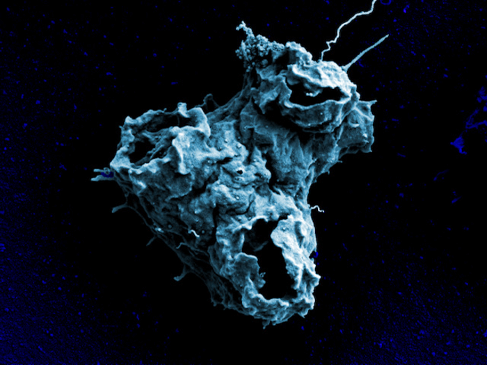 The cell surface of a Naegleria gruberi amoeba