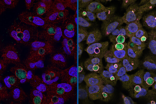 At left: A wild type Chlamydia (green) surrounded by the GarD protein; Right: Chlamydia with GarD knocked out