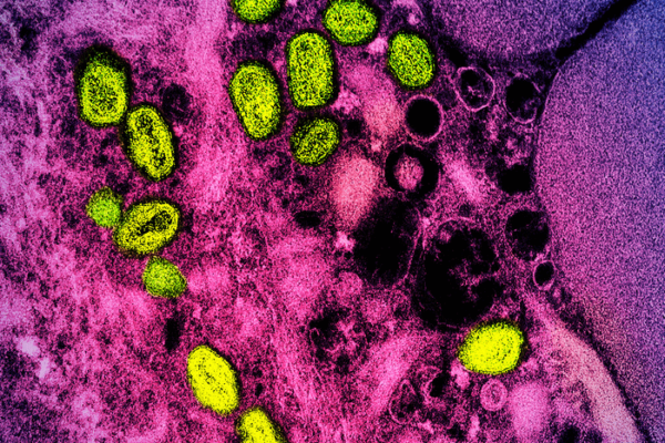 monkeypox virus