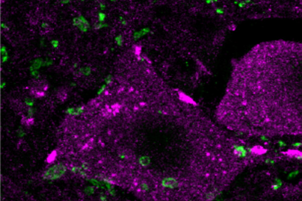 Epigenetic treatment in mice improves spinal cord regeneration after injury