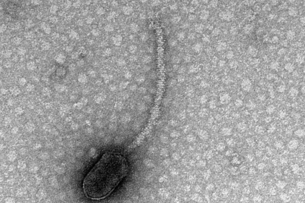virus