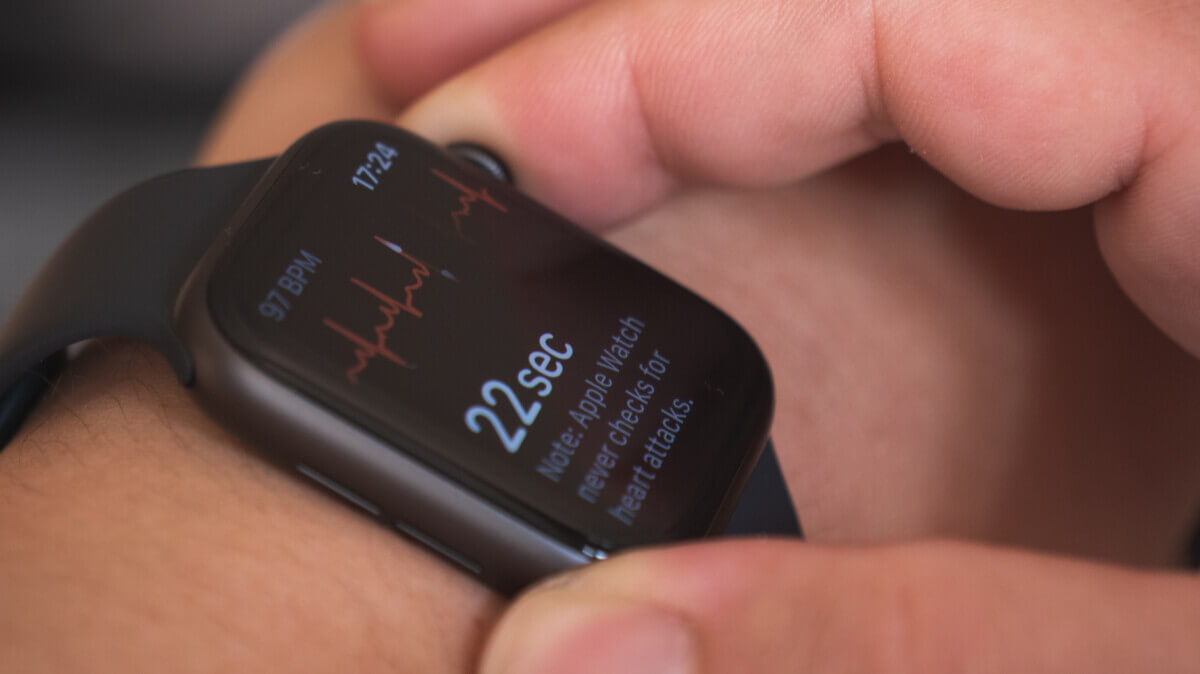Smartwatch wearable technology measuring heart rhythm via ECG