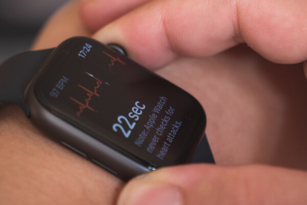 Apple Watch: Smartwatch wearable technology measuring heart rhythm via ECG