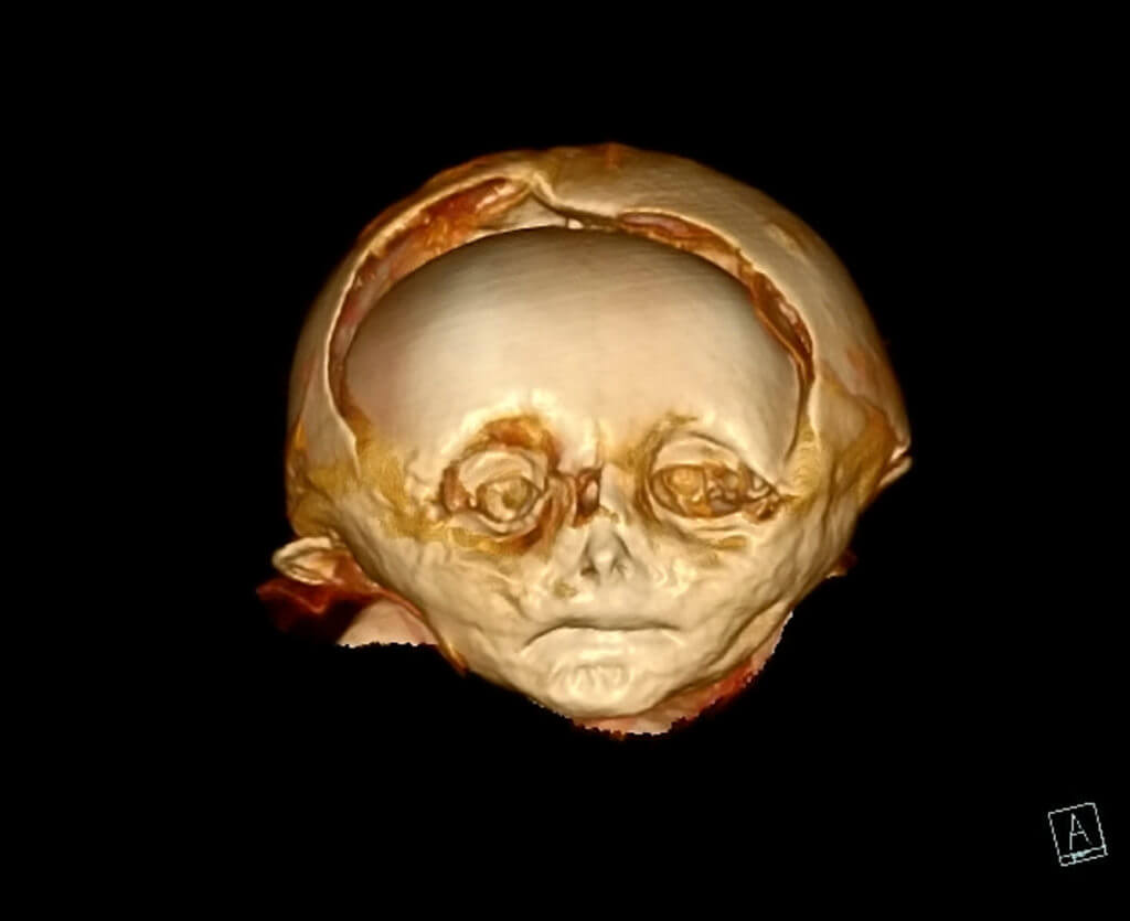 CT scan of the mummy's head
