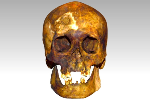 3D scan of skull of John Barber.