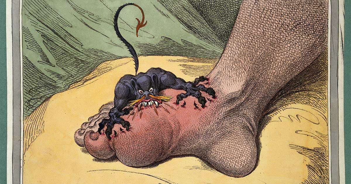 The Gout