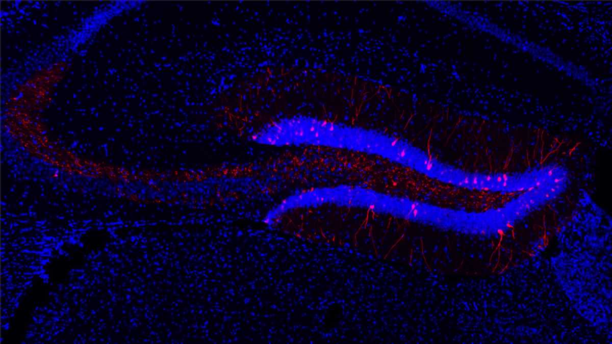 A mouse hippocampus under a microscope.