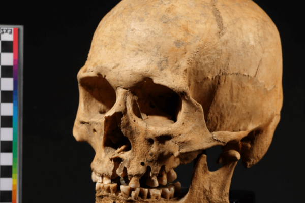 Closeup image of a human skull