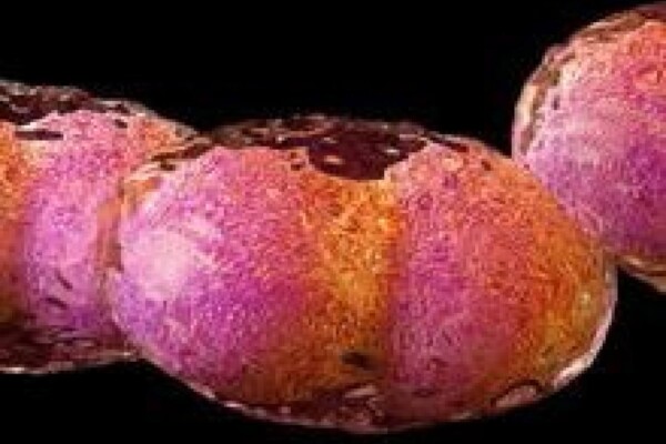 Closeup image of the smallpox virus