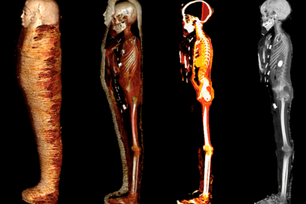 4 images of a mummy showing his skeleton and outer wrappings