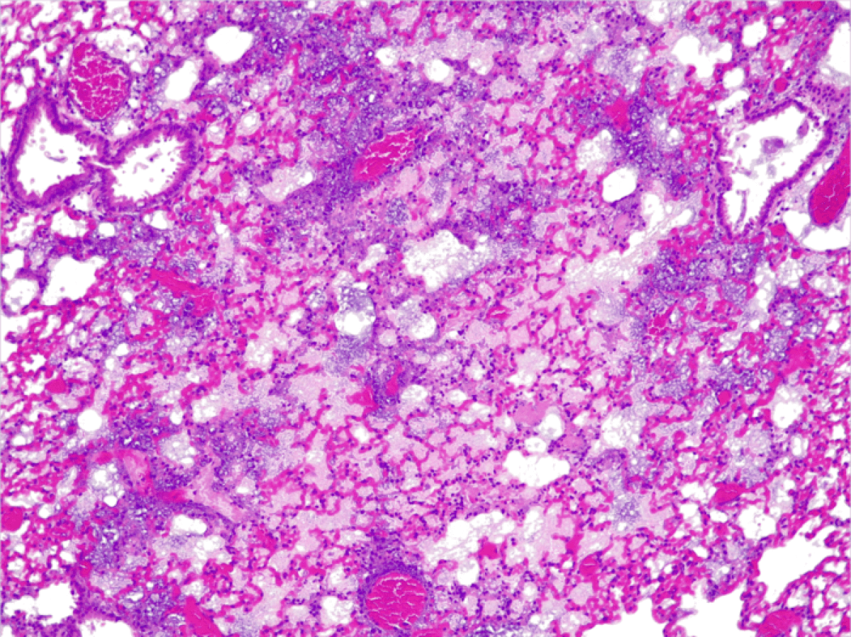 Microscopic view of a lung infection in a mouse