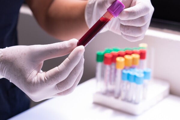 A medical technician holds a blood sample