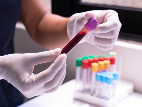 A medical technician holds a blood sample