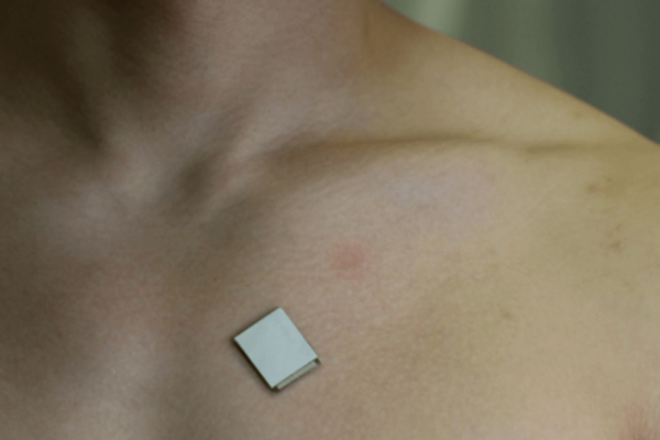 A small patch on a man's chest